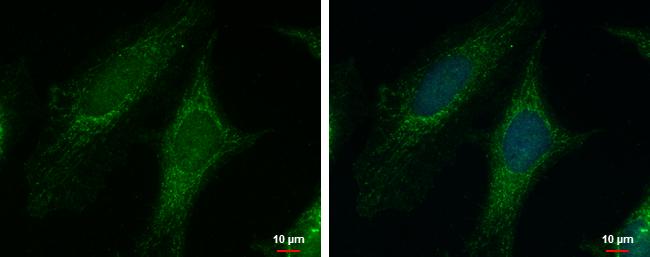 PYCR1 Antibody in Immunocytochemistry (ICC/IF)