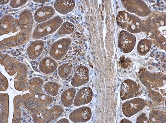 RPL3 Antibody in Immunohistochemistry (Paraffin) (IHC (P))