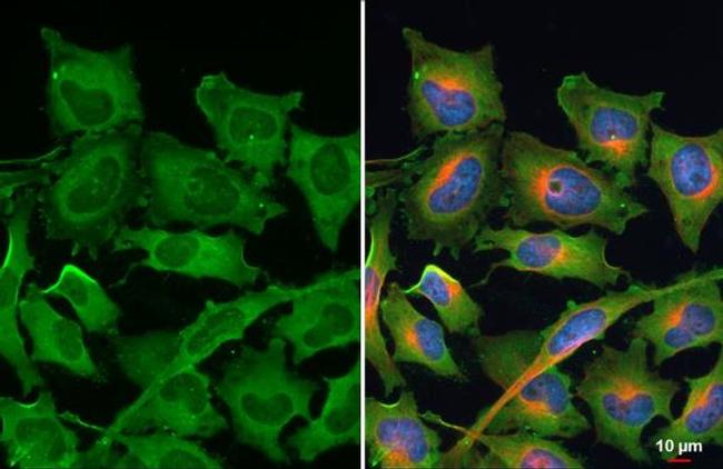 RPL24 Antibody in Immunocytochemistry (ICC/IF)