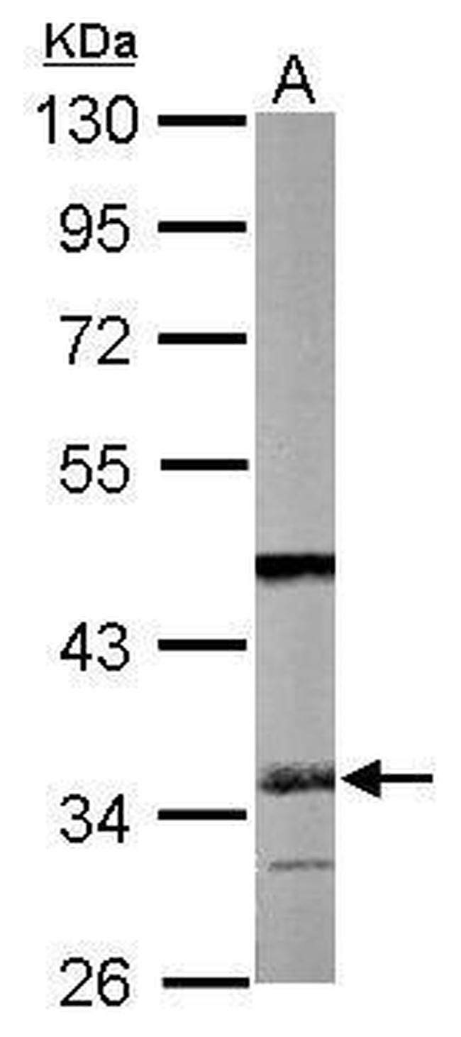 SGTA Antibody in Western Blot (WB)