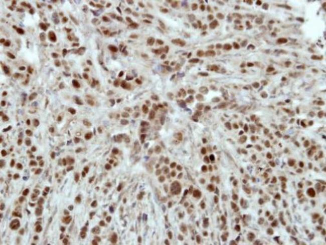 HLTF Antibody in Immunohistochemistry (Paraffin) (IHC (P))