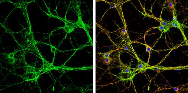 MUNC18 Antibody in Immunocytochemistry (ICC/IF)