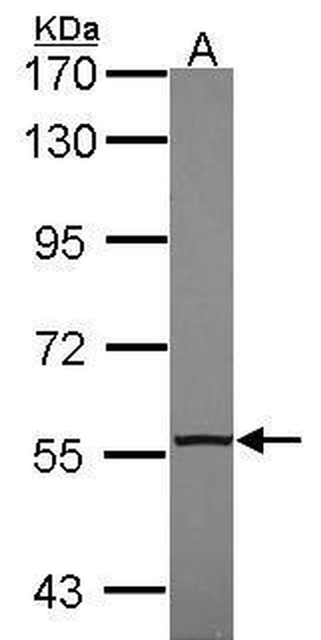 NR2C2 Antibody in Western Blot (WB)