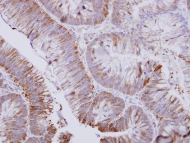 UMPS Antibody in Immunohistochemistry (Paraffin) (IHC (P))