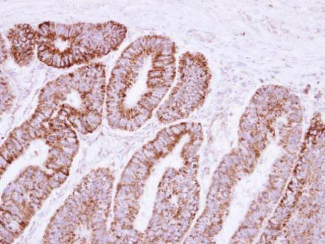 VDAC2 Antibody in Immunohistochemistry (Paraffin) (IHC (P))