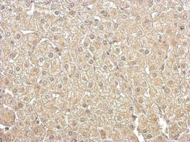 Aldolase B Antibody in Immunohistochemistry (Paraffin) (IHC (P))