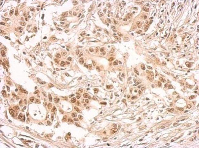 SRSF1 Antibody in Immunohistochemistry (Paraffin) (IHC (P))