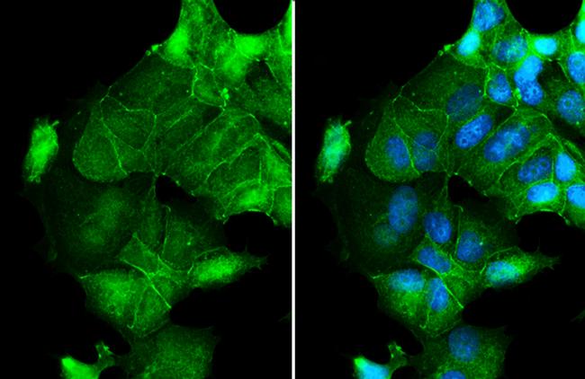 Occludin Antibody in Immunocytochemistry (ICC/IF)