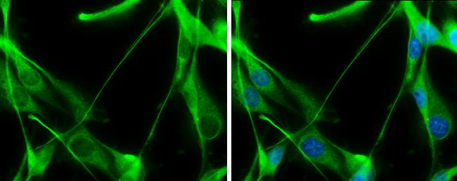 TALDO1 Antibody in Immunocytochemistry (ICC/IF)