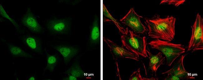 ERF Antibody in Immunocytochemistry (ICC/IF)