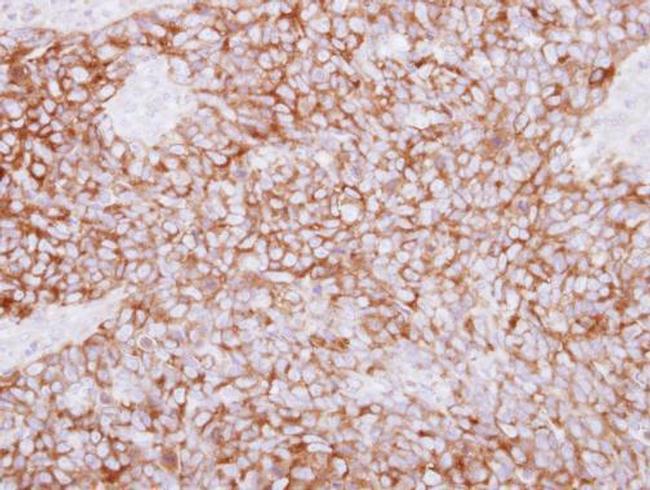 PLCD1 Antibody in Immunohistochemistry (Paraffin) (IHC (P))