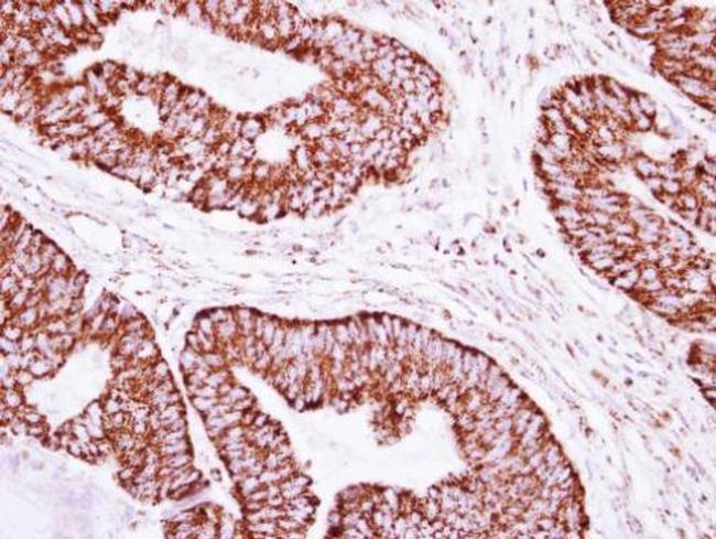 CLPP Antibody in Immunohistochemistry (Paraffin) (IHC (P))