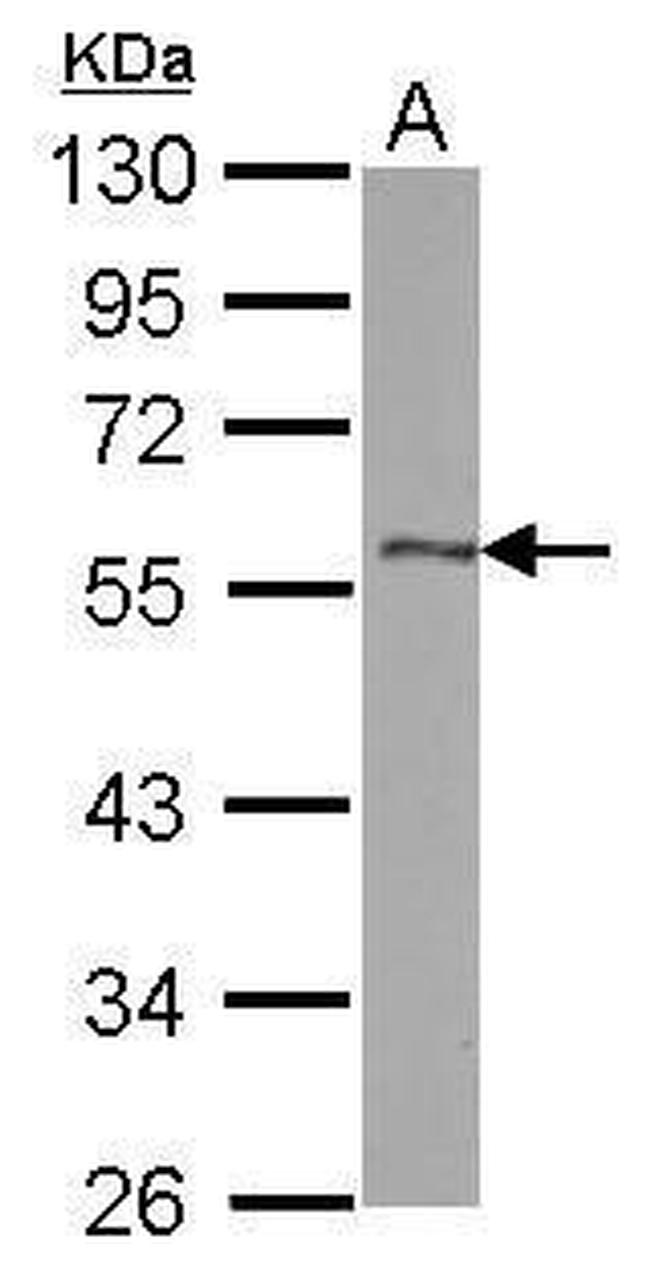 DLK1 Antibody in Western Blot (WB)