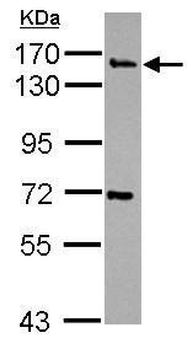 Synaptojanin 2 Antibody in Western Blot (WB)