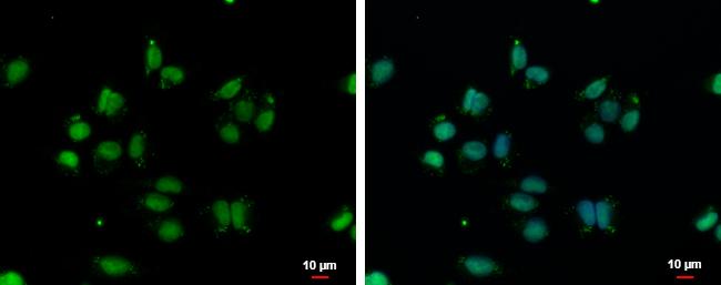 VPS4B Antibody in Immunocytochemistry (ICC/IF)