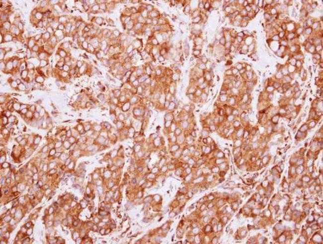 ERP72 Antibody in Immunohistochemistry (Paraffin) (IHC (P))