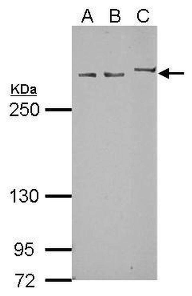 Myomegalin Antibody in Western Blot (WB)