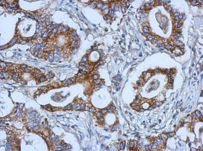 KIAA0196 Antibody in Immunohistochemistry (Paraffin) (IHC (P))