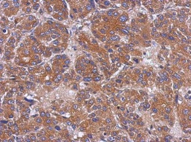 TOM1L1 Antibody in Immunohistochemistry (Paraffin) (IHC (P))