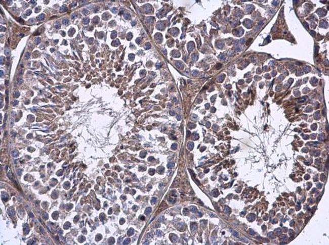 FARSB Antibody in Immunohistochemistry (Paraffin) (IHC (P))