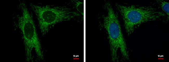 LRP130 Antibody in Immunocytochemistry (ICC/IF)