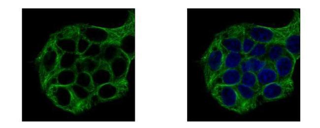 Vinexin Antibody in Immunocytochemistry (ICC/IF)