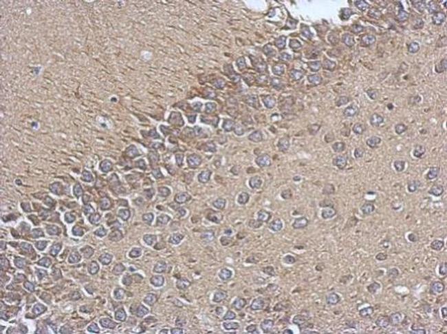 TIM17 Antibody in Immunohistochemistry (Paraffin) (IHC (P))