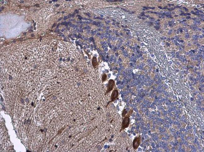 BAIAP2 Antibody in Immunohistochemistry (Paraffin) (IHC (P))