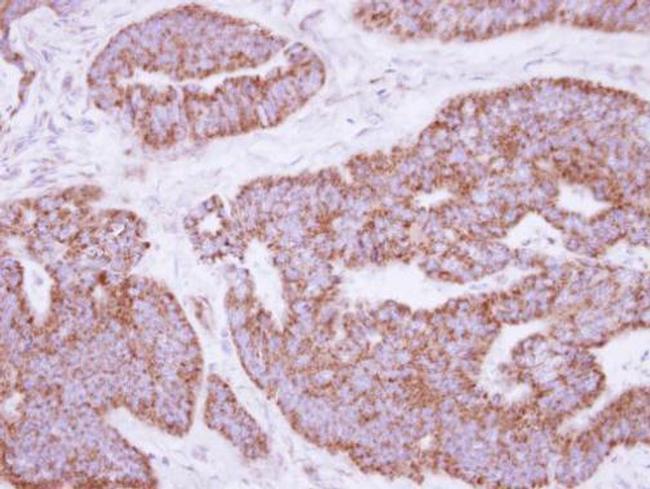 MRPL28 Antibody in Immunohistochemistry (Paraffin) (IHC (P))