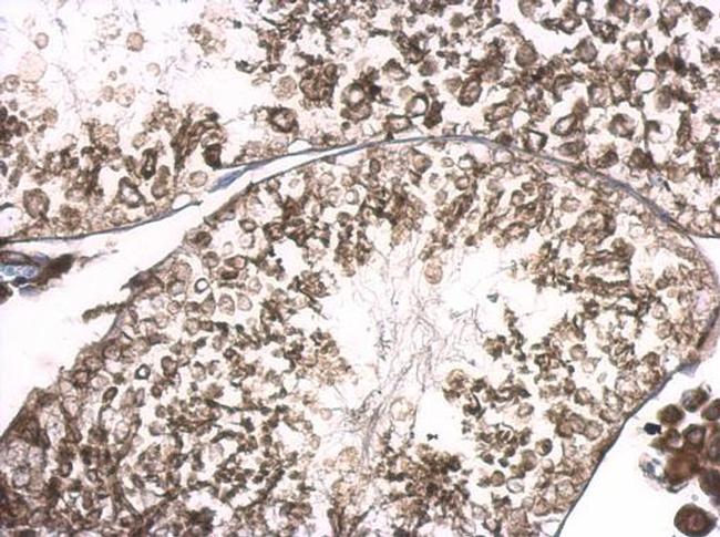 RGS14 Antibody in Immunohistochemistry (Paraffin) (IHC (P))