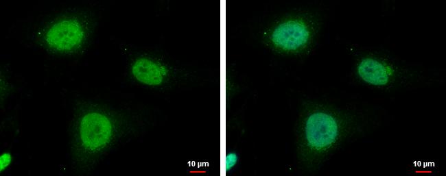 IGF2BP3 Antibody in Immunocytochemistry (ICC/IF)