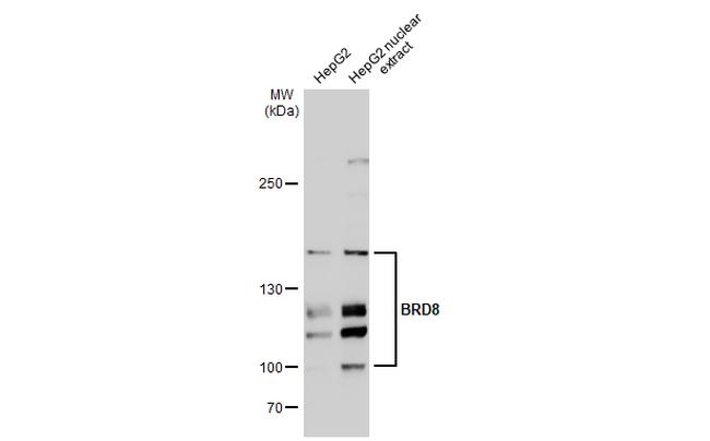 BRD8 Antibody in Western Blot (WB)