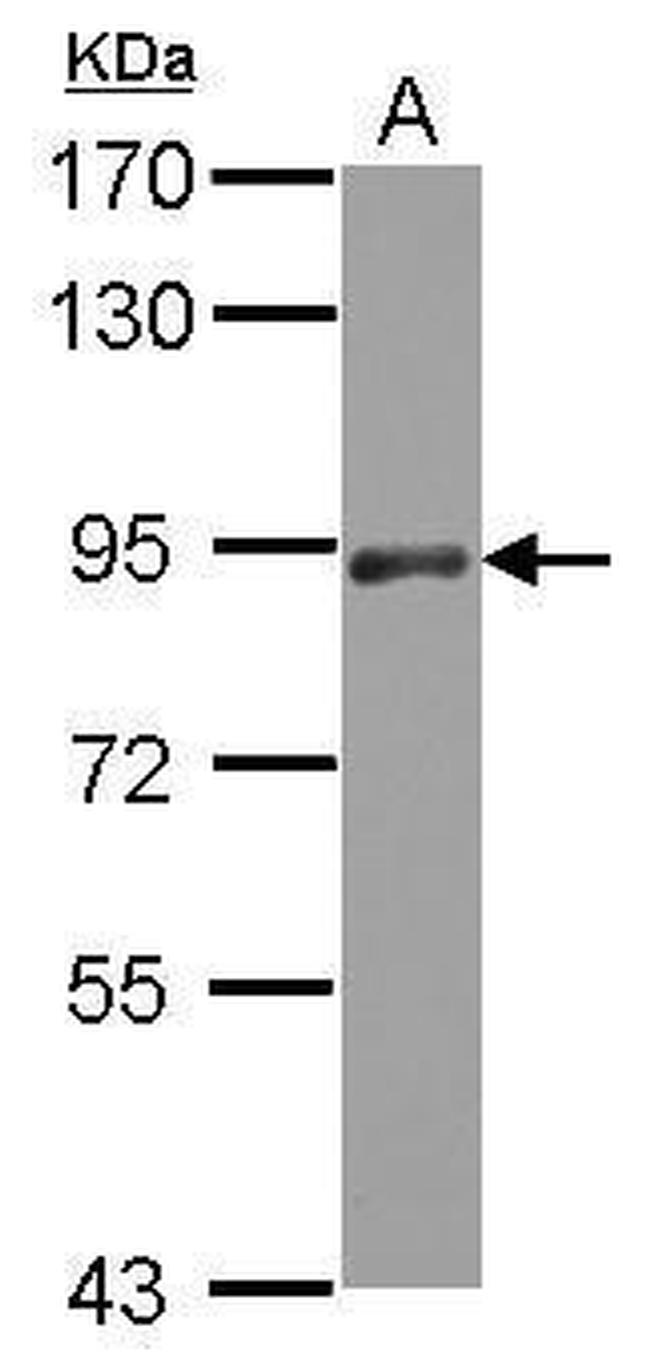 PAPOLA Antibody in Western Blot (WB)