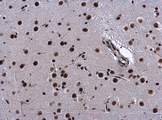 HP1 beta Antibody in Immunohistochemistry (Paraffin) (IHC (P))