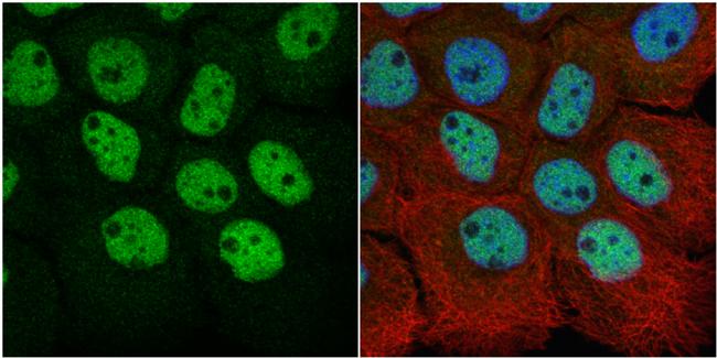 RbAp48 Antibody in Immunocytochemistry (ICC/IF)