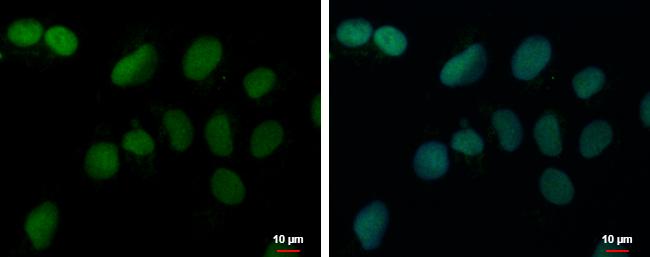 PRDM4 Antibody in Immunocytochemistry (ICC/IF)