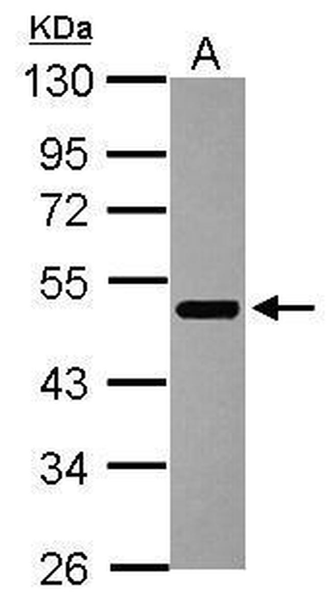 IKZF3 Antibody in Western Blot (WB)