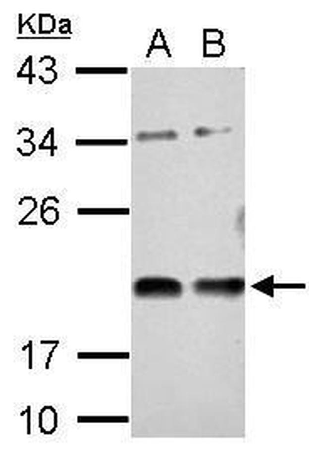 VASH1 Antibody in Western Blot (WB)