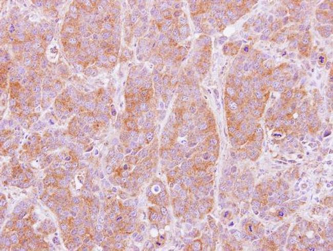 NT5C2 Antibody in Immunohistochemistry (Paraffin) (IHC (P))