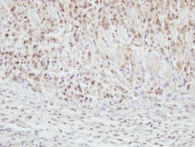 CLASP1 Antibody in Immunohistochemistry (Paraffin) (IHC (P))