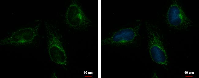 ACOT9 Antibody in Immunocytochemistry (ICC/IF)