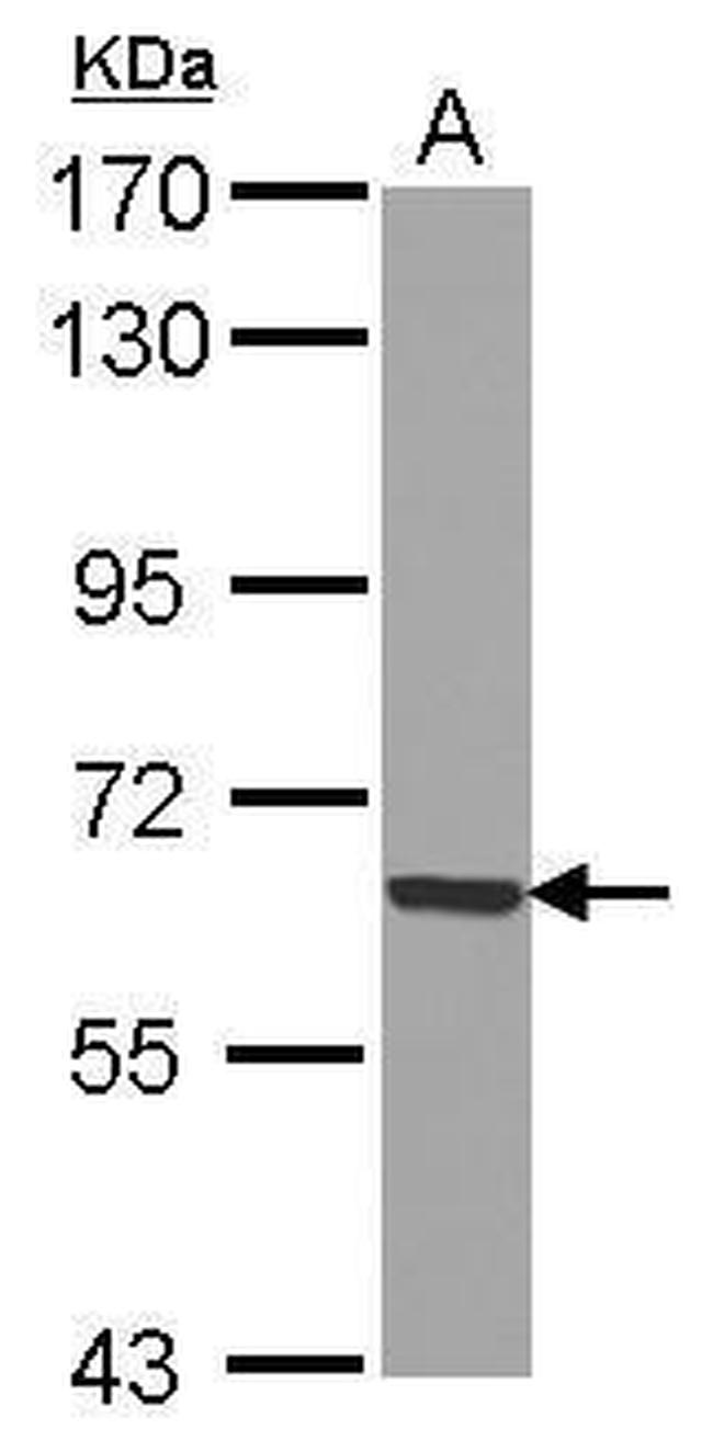 GADD34 Antibody in Western Blot (WB)