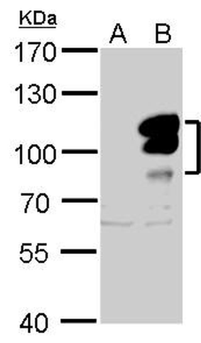 L3MBTL1 Antibody in Western Blot (WB)