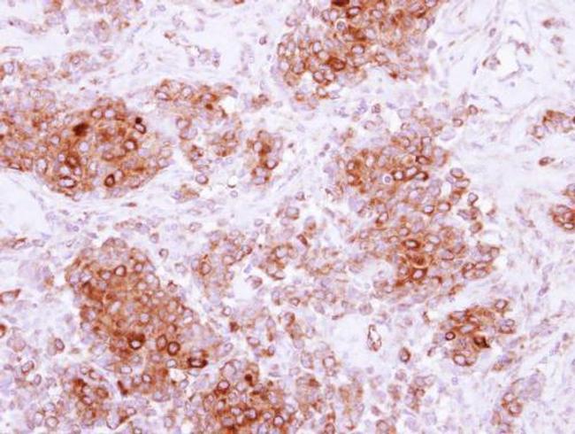 LDLRAP1 Antibody in Immunohistochemistry (Paraffin) (IHC (P))