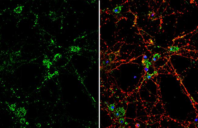 DKK3 Antibody in Immunocytochemistry (ICC/IF)