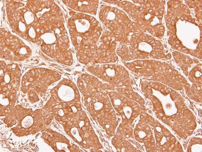 CTNNA3 Antibody in Immunohistochemistry (Paraffin) (IHC (P))