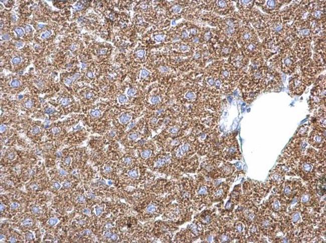 PSAT1 Antibody in Immunohistochemistry (Paraffin) (IHC (P))