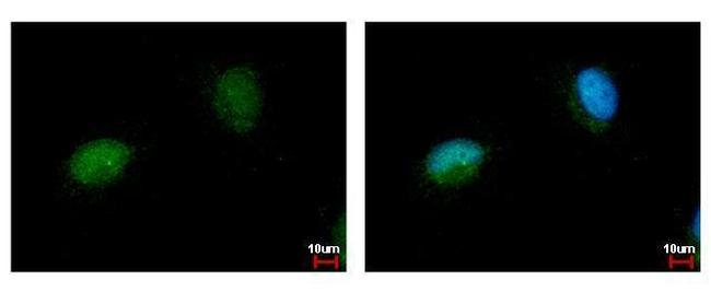 NARF Antibody in Immunocytochemistry (ICC/IF)