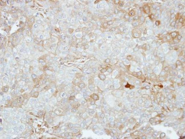 VPS28 Antibody in Immunohistochemistry (Paraffin) (IHC (P))