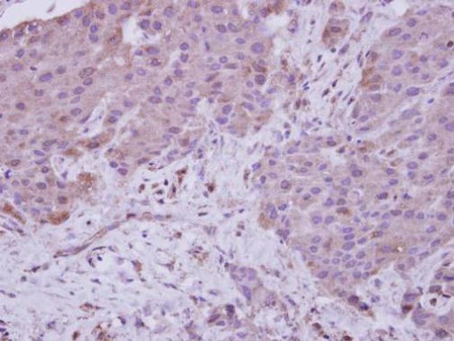 NAA15 Antibody in Immunohistochemistry (Paraffin) (IHC (P))